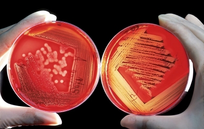Superbugs: Η μεγαλύτερη απειλή αφανισμού του ανθρώπινου είδους;
